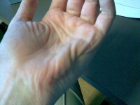 Parkinsons-2-200x150