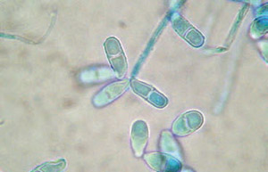 articles-contaminantes-en-cannabis_text_3