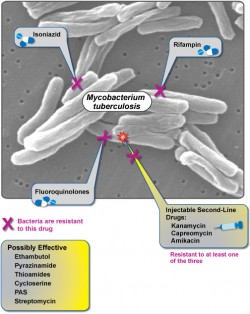 Extensively-drug-resistant-TB-is-an-emerging-threat-and-new-countries-are-reporting-cases-every-year-©-NIAID-250x314