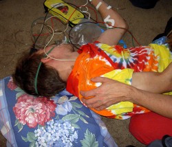 Epilepsy-1-250x214