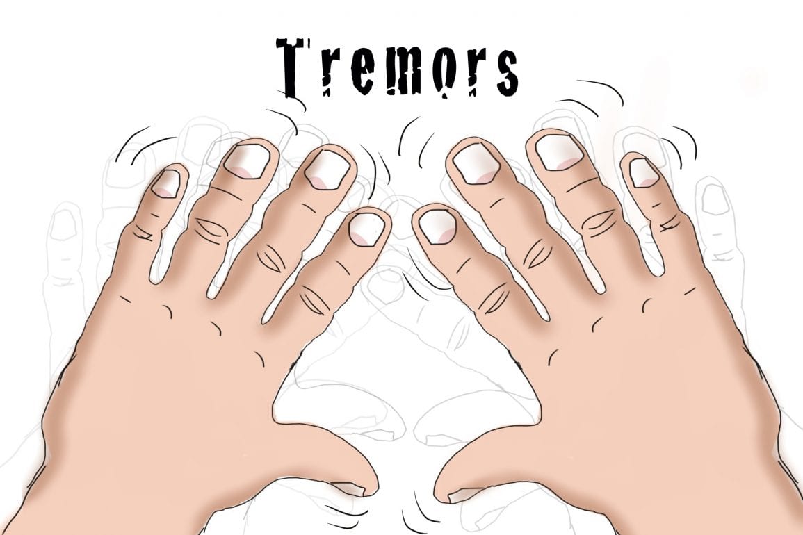 Temblor Esencial - Temblor Esencial : Mauricio Ambriz Twitterissa Diferencias ... - Todos tenemos algo de temblor, pero los movimientos son a menudo tan pequeños que no puede ser vistos.