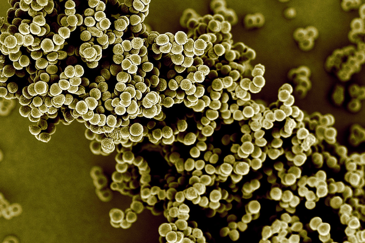 Staphylococcus aureus золотистый стафилококк